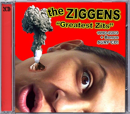 The Ziggens - Greatest Zits